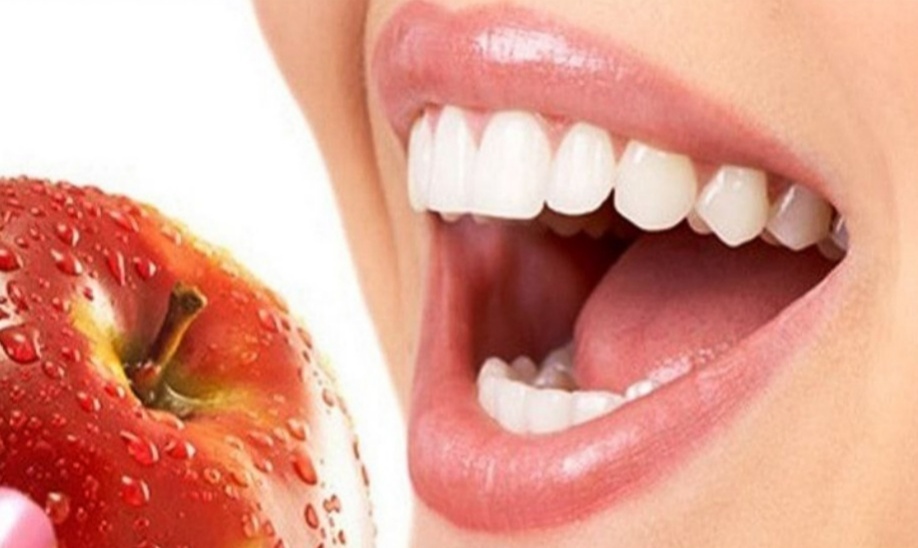 Konsumsi 4 Buah Ini Agar Gigi Putih dan Sehat