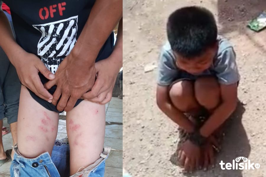Bocah Yatim Piatu Ini Disekap, Kaki dan Tangannya Dirantai
