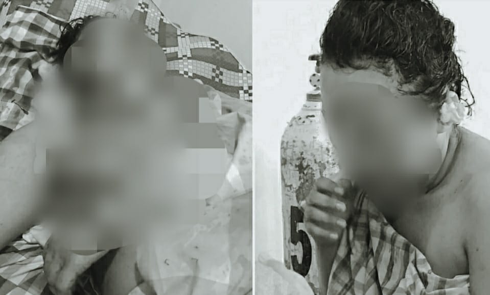 Seorang Suami di Konut Sileti Wajah Istrinya