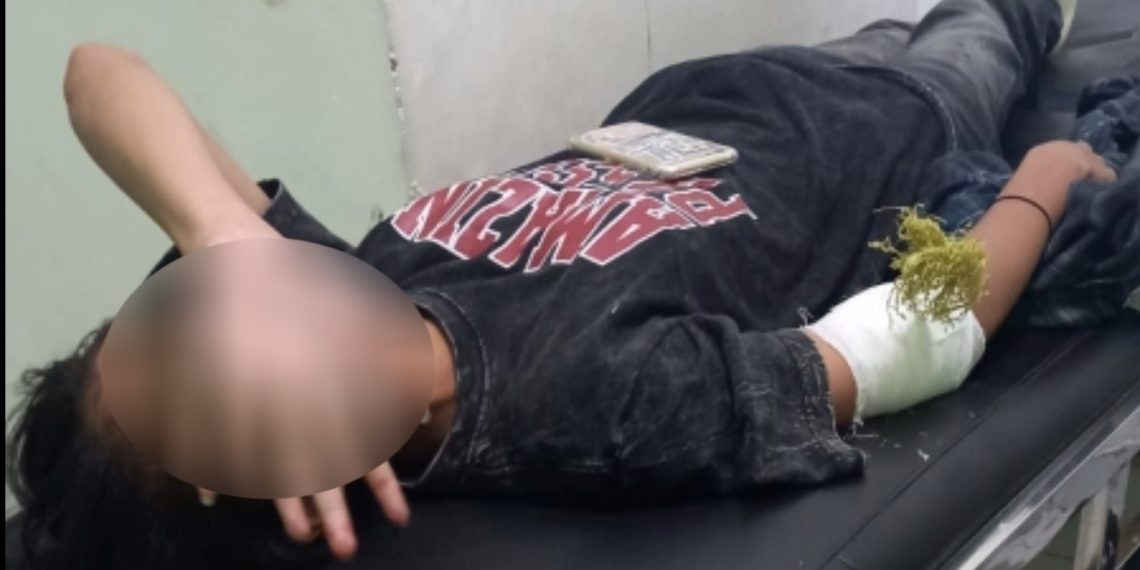 Pembusur Misterius Dikejar Polisi, Korbannya Seorang Wanita