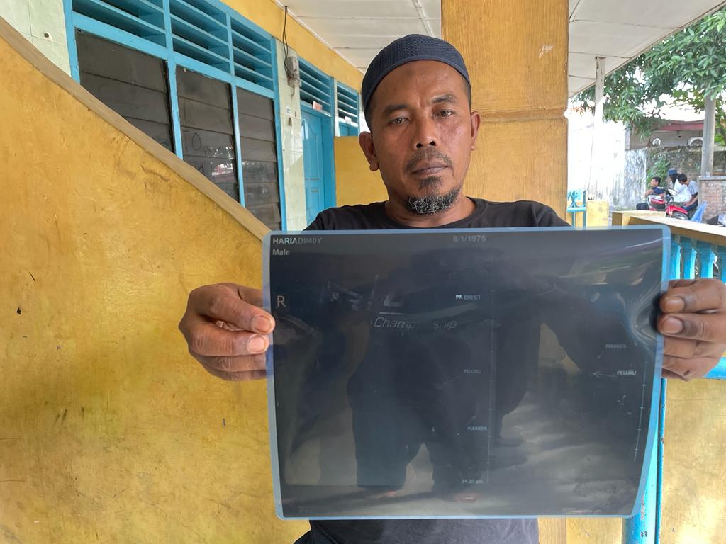 7 Tahun, Kasus Penembakan Abang Becak di Medan Belum Diungkap Polisi