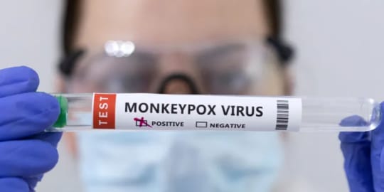 Waspada, Cacar Monyet Bisa Menular Lewat Kontak Langsung atau Benda