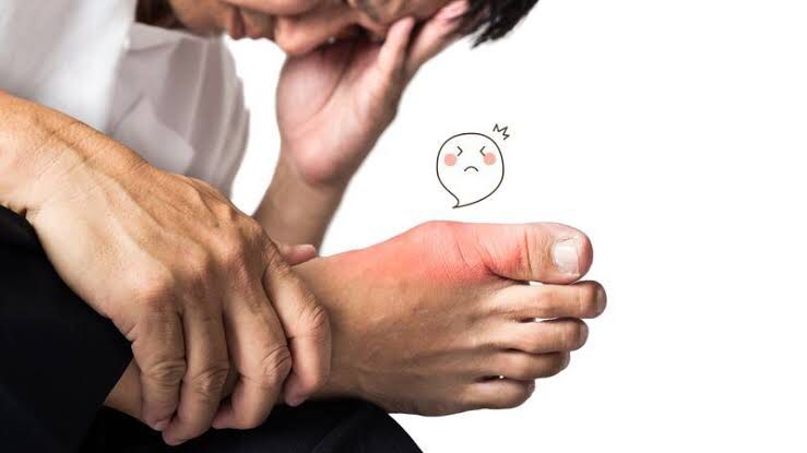 Kenali Penyebab Serta Pilihan Makanan yang Tepat Bagi Rematik Asam Urat