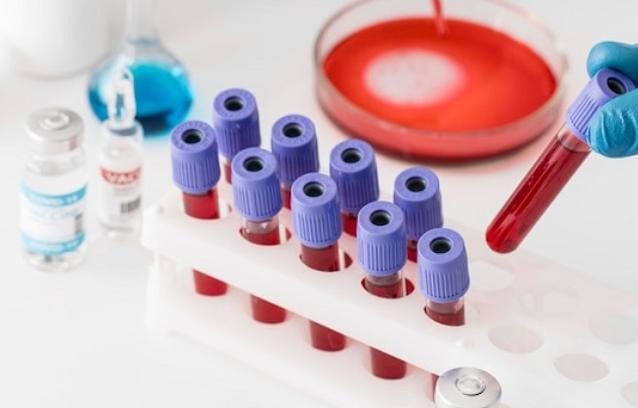 Ilmuan Temukan Golongan Darah Baru Secara Tak Sengaja