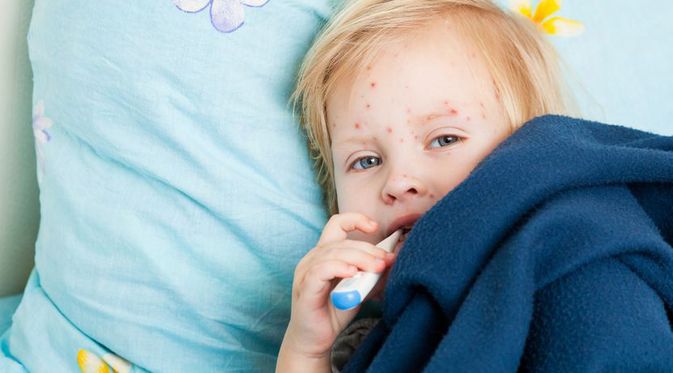 Catat, Ini 4 Cara Mencegah Campak pada Anak