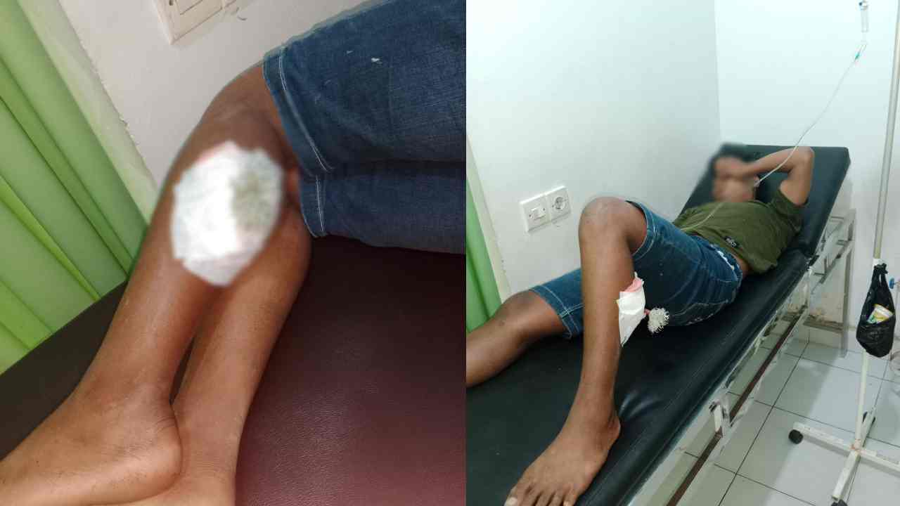 Diserang Saat Nongkrong Seorang Pelajar di Kota Kendari Terkena Busur
