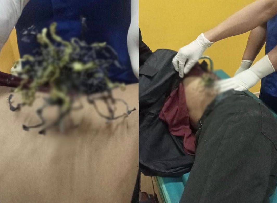 Karyawan PT VDNI Dibusur Depan Kampus UHO