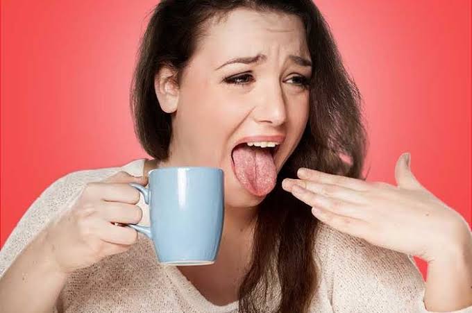 5 Cara Meredakan Lidah Perih Akibat Kepanasan