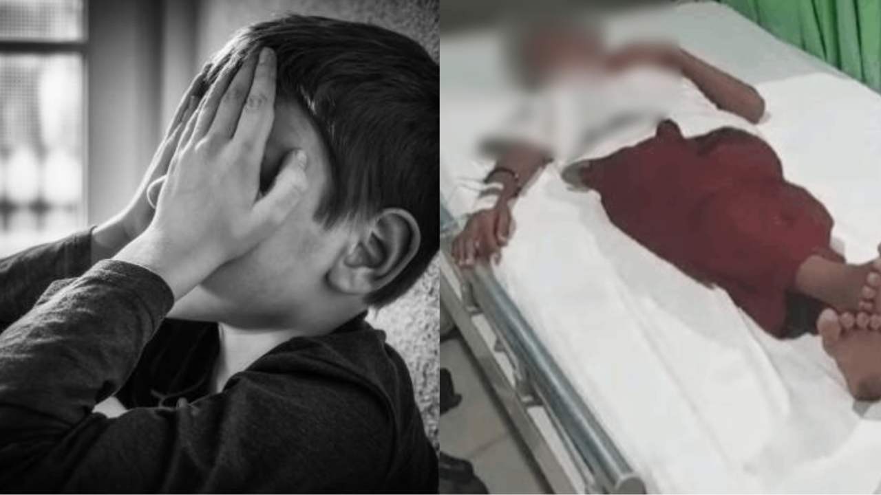 Kepala Dibenturkan ke Tembok hingga Pendarahan, Murid SD di Kendari Dirawat Tak Ditanggung BPJS