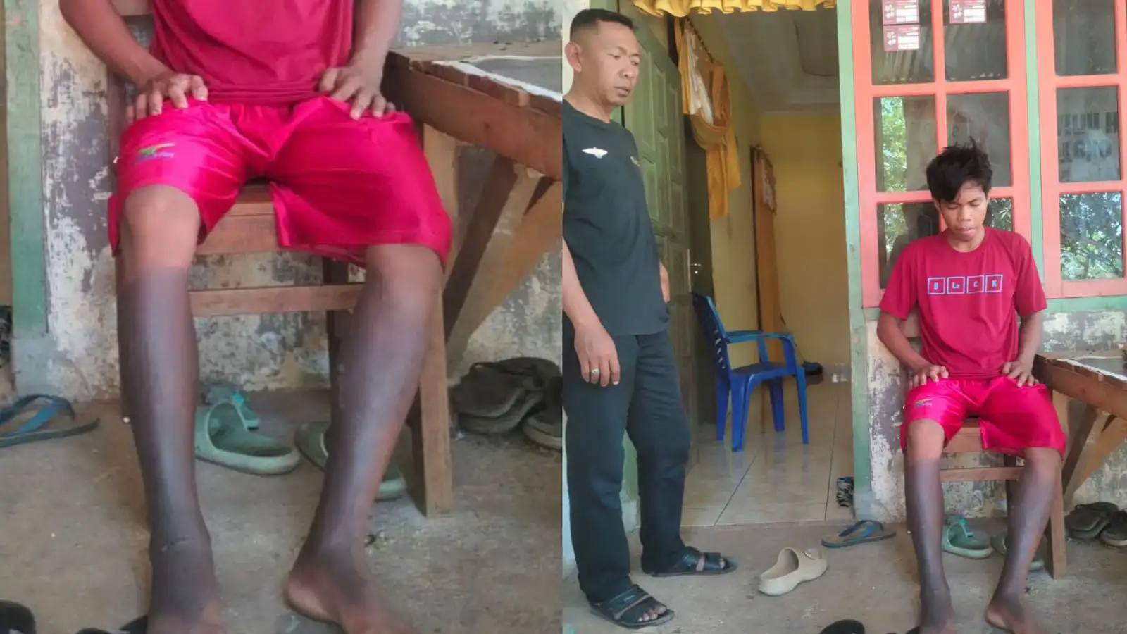 Pabrik Tandon di Kota Baubau Tak Berizin, Dua Karyawan Alami Luka Bakar