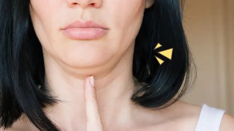 Tak Percaya Diri dengan Double Chin, Ini Cara Hilangkan