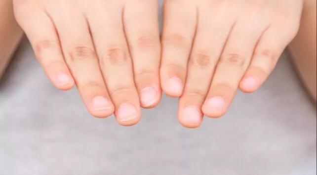 Tips Merawat Kuku Agar Tetap Sehat dan Cantik