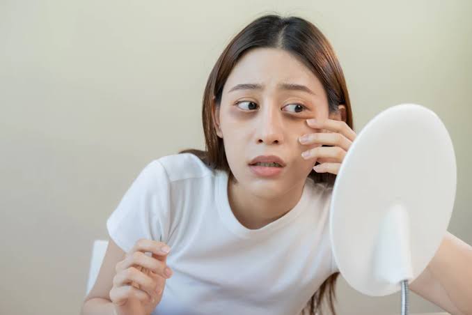 7 Cara Alami Hilangkan Mata Panda dengan Cepat