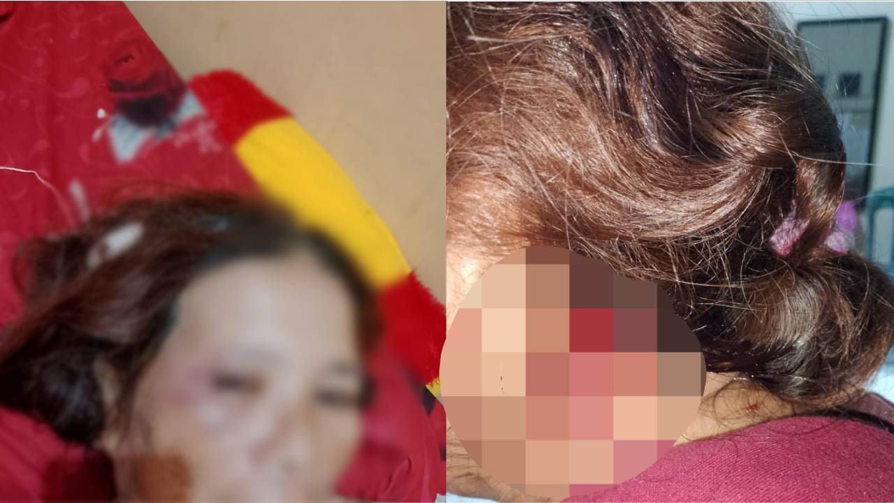 Tak Terima Ditanya Uang Saku Suami Aniaya Istri dan Suruh Jadi PSK