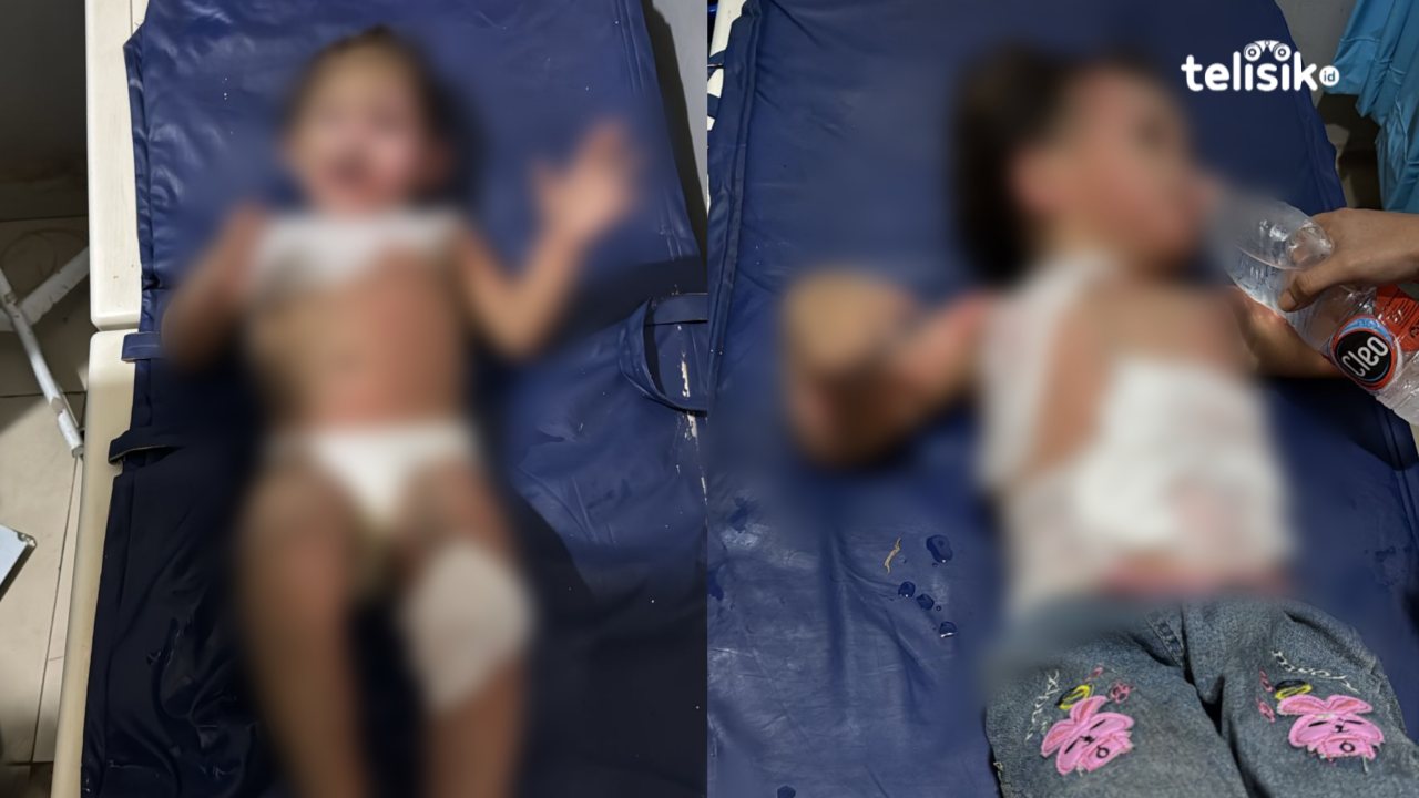 Dua Balita Tewas dan Dua Korban Lain Sekarat Akibat Kebakaran Hebat di Kendari