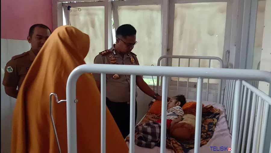 Kapolres Bombana, AKBP Andi Herman, S.IK saat membesuk Faqih bocah pengidap gizi buruk. Foto: Hir/Telisik