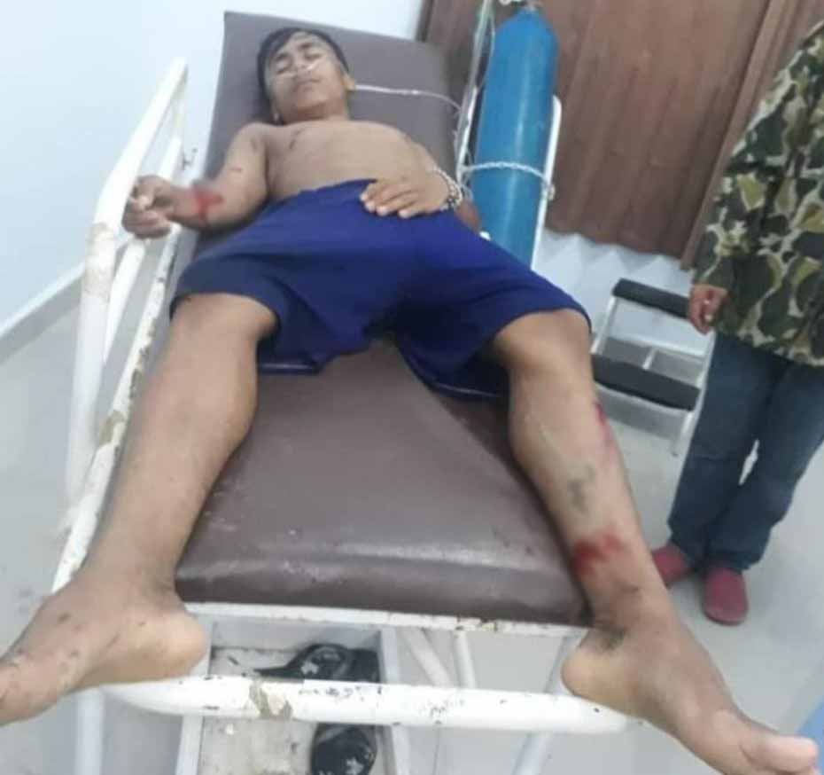 Korban Iya nyaris tewas di gigita buaya, Foto : Kabid Humas Polda Sultra