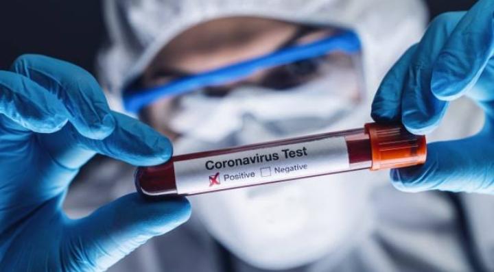 Coronavirus Test. Foto: Repro Strategy PR