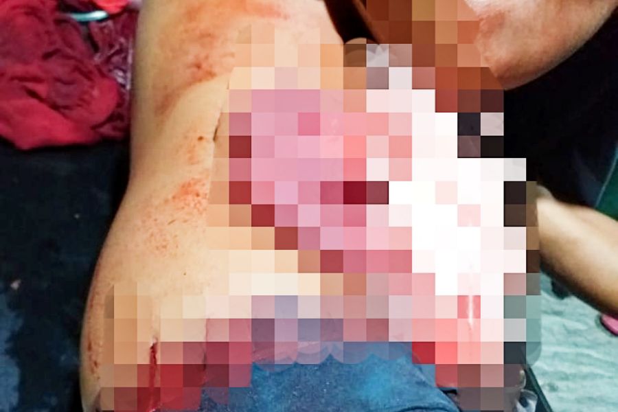 Kondisi korban dengan usus keluar saat ditangani tim medis. Foto: Ist.