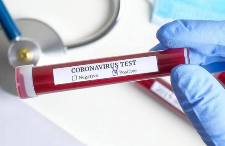 Coronavirus Tes. Foto: Repro AyoCirebon.com