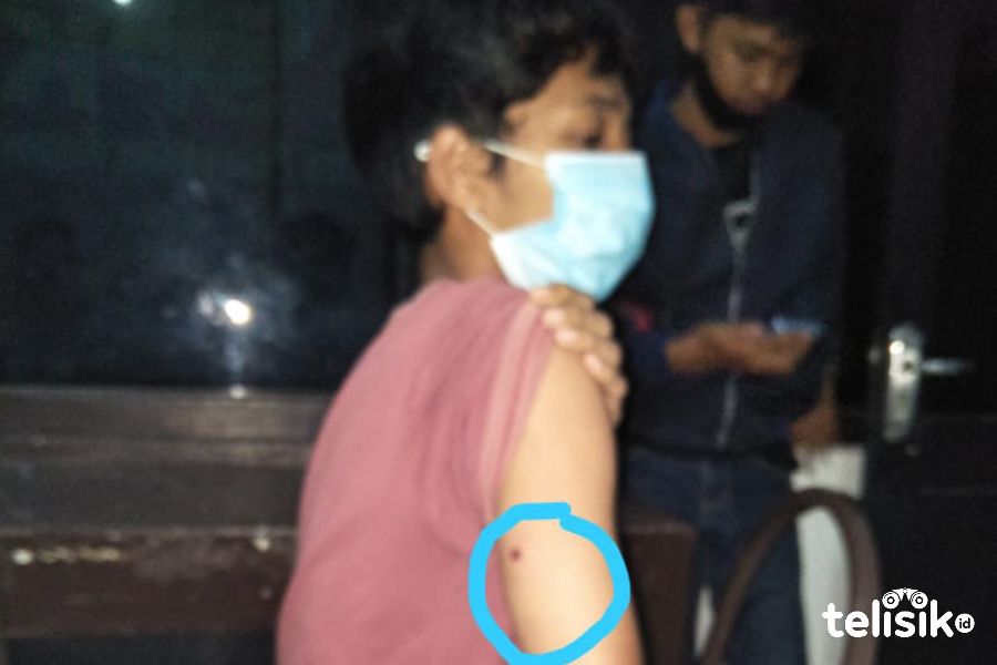 Korban Ahyat memperlihatkan lengannya yang kena tembak. Foto: Thamrin Dalby/Telisik
