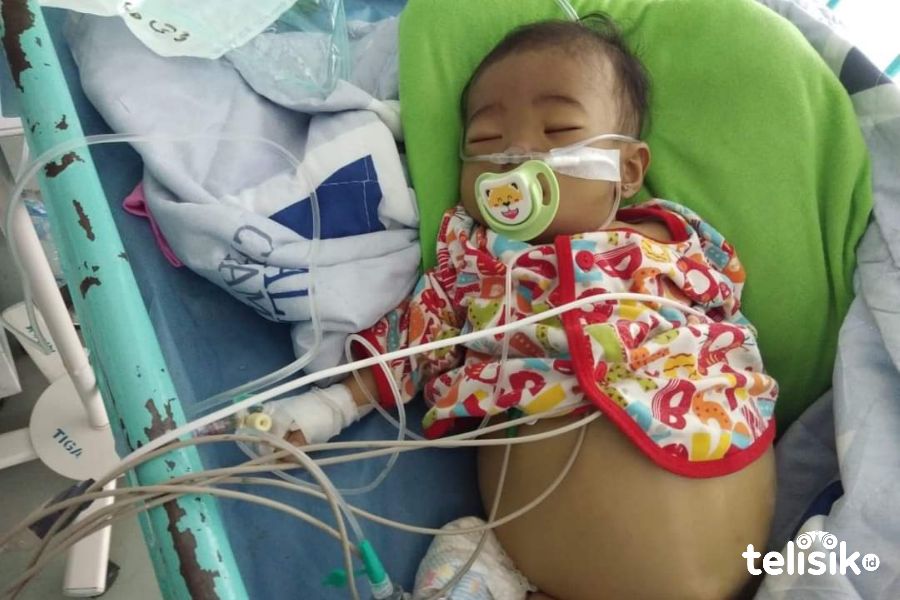 Nadine Sohaga Gulo saat dirawat di Rumah Sakit Cipto Mangunkusumo (RSCM) Jakarta. Foto: Ones Lawolo/Telisik