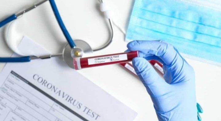 Coronavirus. Foto: Repro Tribunnewswiki.com