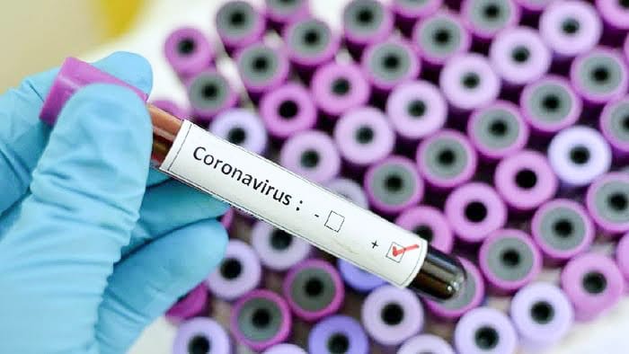 Ilustrasi positif COVID-19. Foto: Repro google