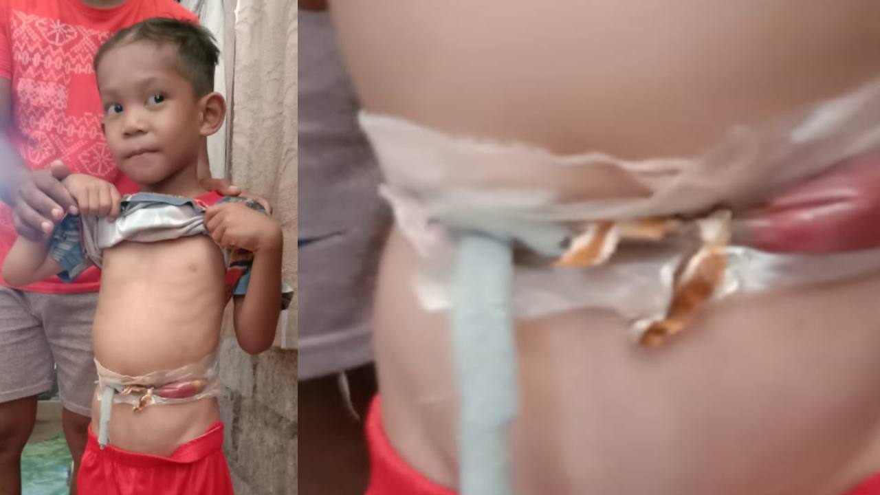 Faris Naufal di Buton Tengah yang terlahir cacat. Foto: Ist.