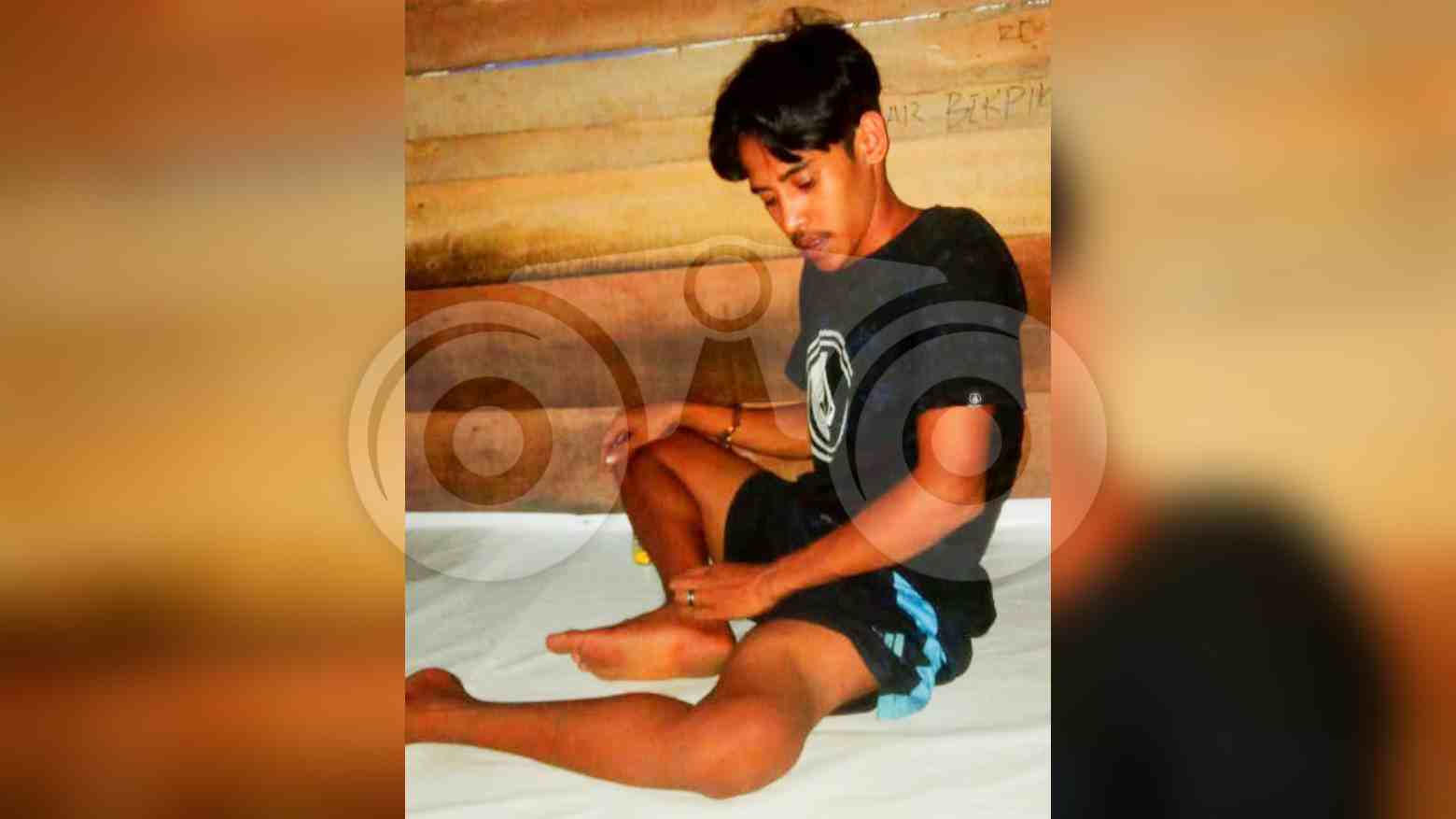 Abdul Asis yang menderita patah tulang. Foto: Sadar/Telisik