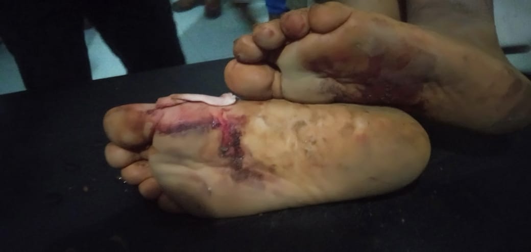 Korban kekerasan. Foto: Ist.