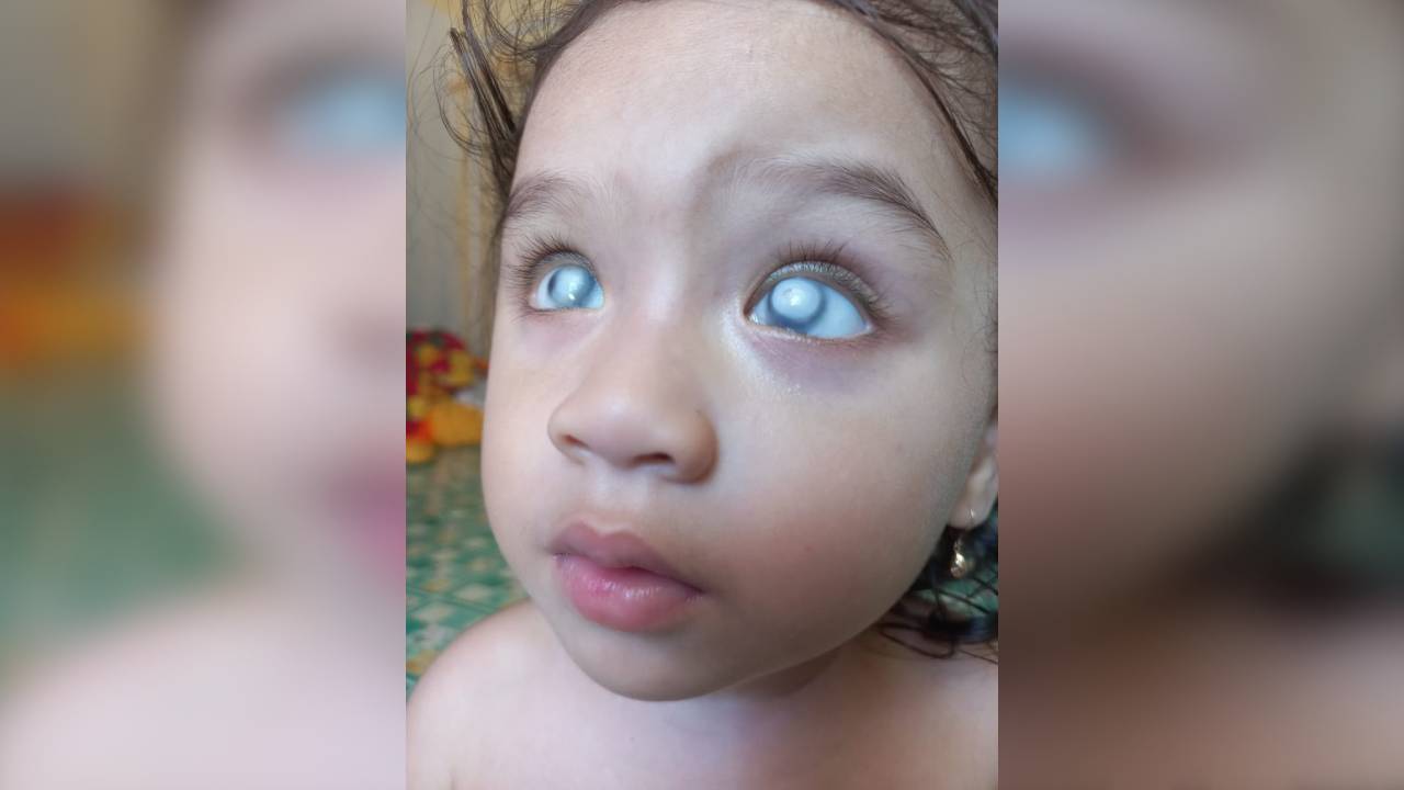 Bayi Zahida Qalbi Nadifa yang membutuhkan uluran tangan para dermawan  Foto: Ist