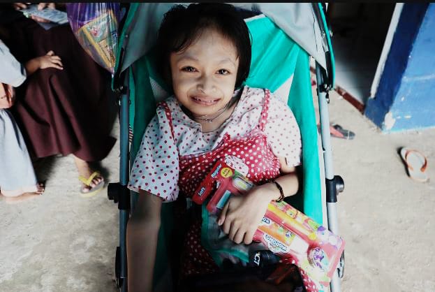 Kondisi Nur saat ini, anak berusia 14 tahun, yang memiliki kelainan sejak lahir. Foto: Ist
