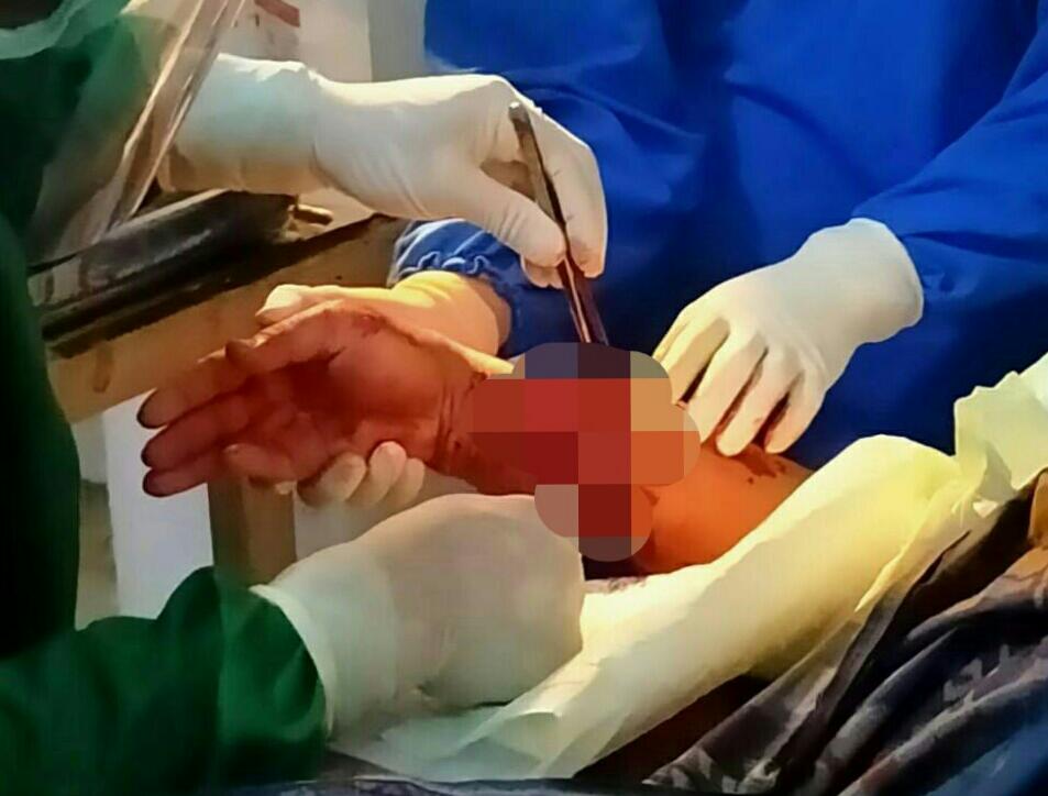 Ilustrasi seseorang yang digigit buaya sedang ditangani tim medis. Foto: repro indopena.com
