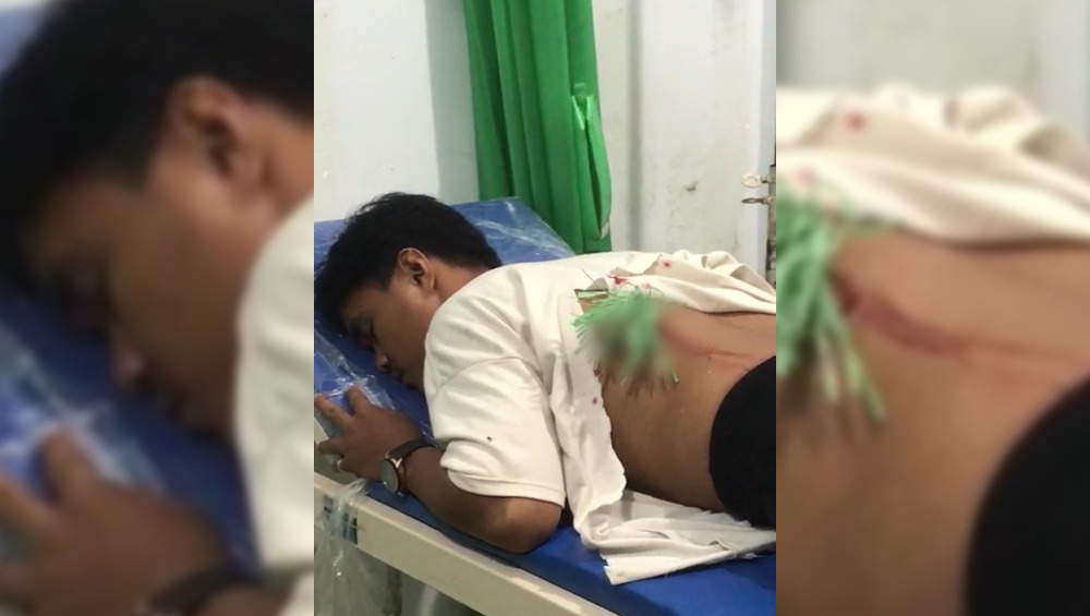 Dengan menahan rasa sakit, pemuda asal Kecamatan Moramo, Konawe Selatan, Guntur mendapatkan perawatan usai dibusur orang tak dikenal. Foto: screenshoot video