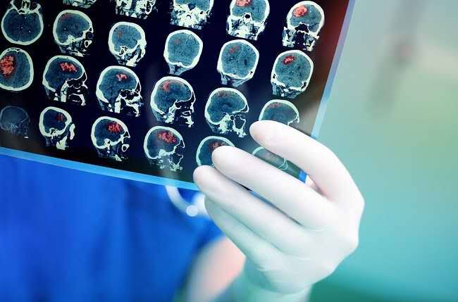Kanker jadi penyakit yang paling berbahaya sehingga wajib diwaspadai. Foto: Repro alodokter.com