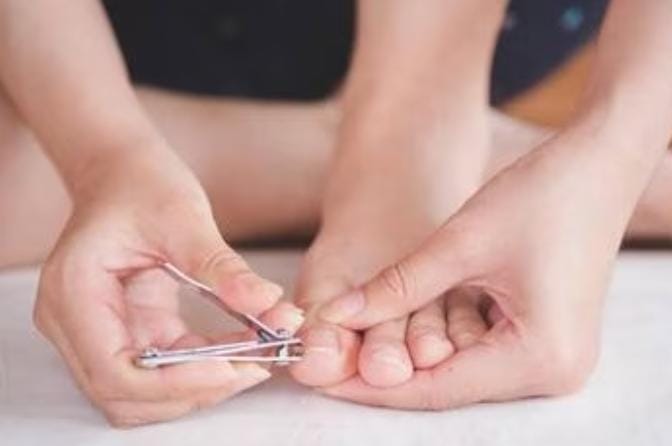 Sebagian dari kita mungkin pernah mengalami cantengan. Cantengan adalah tumbuhnya salah satu sisi kuku atau ujung kuku masuk ke dalam daging. Foto: Repro Stylo.id