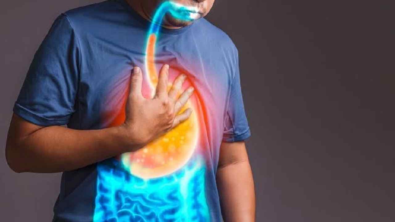 Asam lambung naik kebanyakan dikarenakan habis mengonsumsi makanan tertentu. Foto: Repro google.com