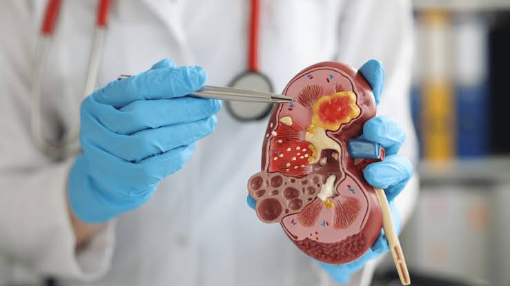 Salah satu manfaat puasa adalah karena dapat meningkatkan metabolisme tubuh. Foto: rsbudimedika.com