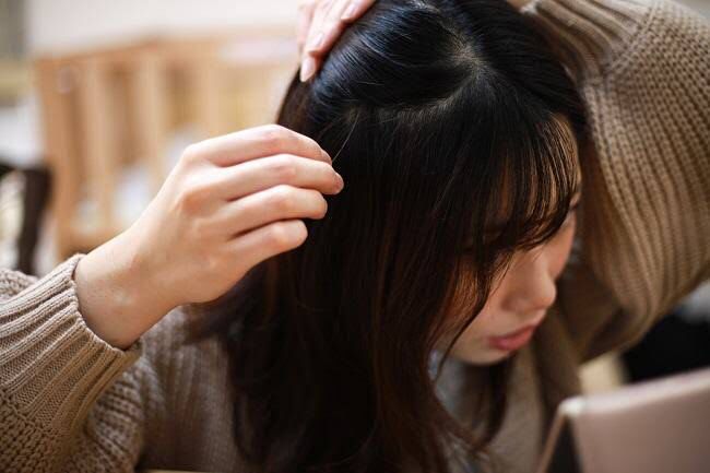 Muncul uban di rambut merupakan bagian alami dari penuaan. Namun, ada pula bukti yang menunjukkan bahwa stres dapat mempercepat proses munculnya uban di rambut. Foto: Repro Alodokter.com