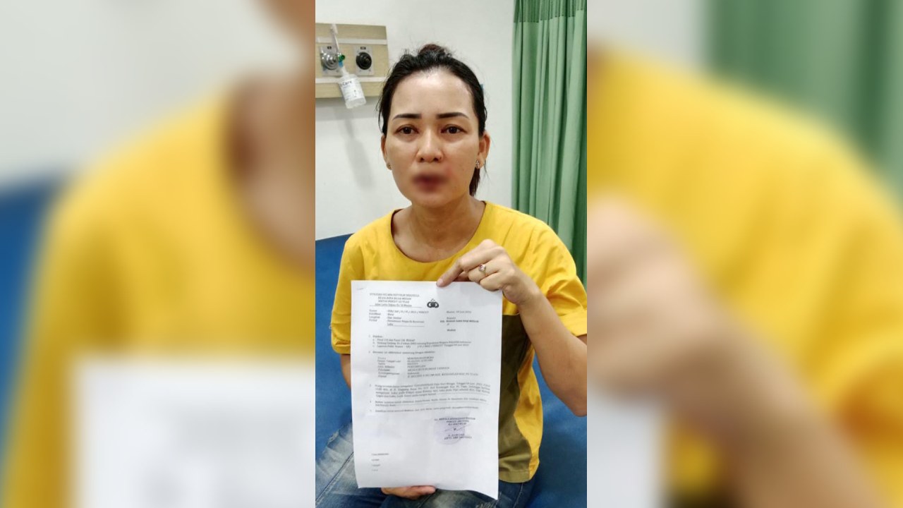 Korban dalam kondisi terluka usai dianiaya dan melaporkan kasus yang dialaminya ke polisi. Foto: Dokumentasi keluarga korban