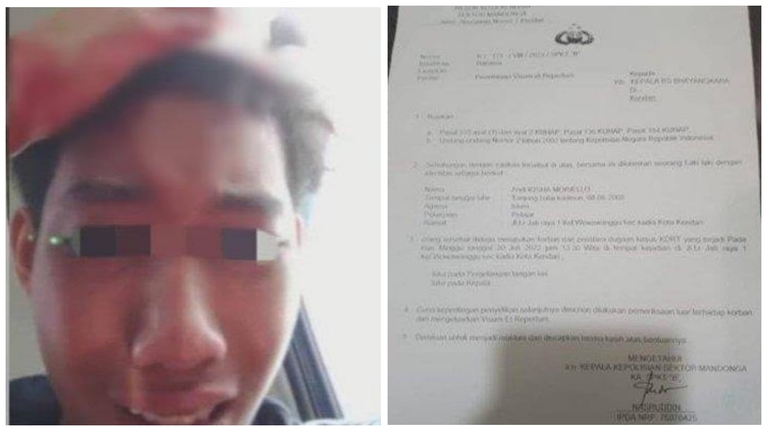 Kondisi Andi Iqsha Morileo (15) usai dianiaya AJK yang merupakan salah satu hakim di Sulawesi Tenggara. Foto: Ist.