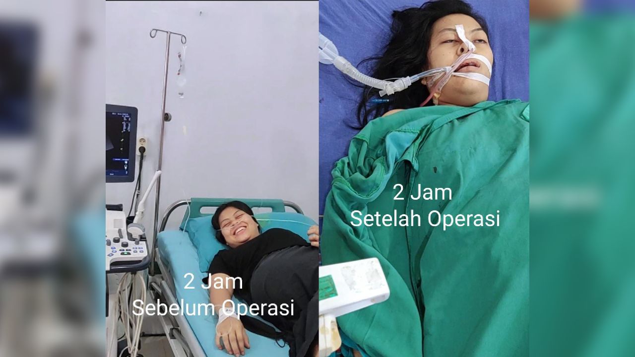 Kondisi korban sebelum dan sesudah dioperasi. Foto: Dokumentasi keluarga pelapor atau korban
