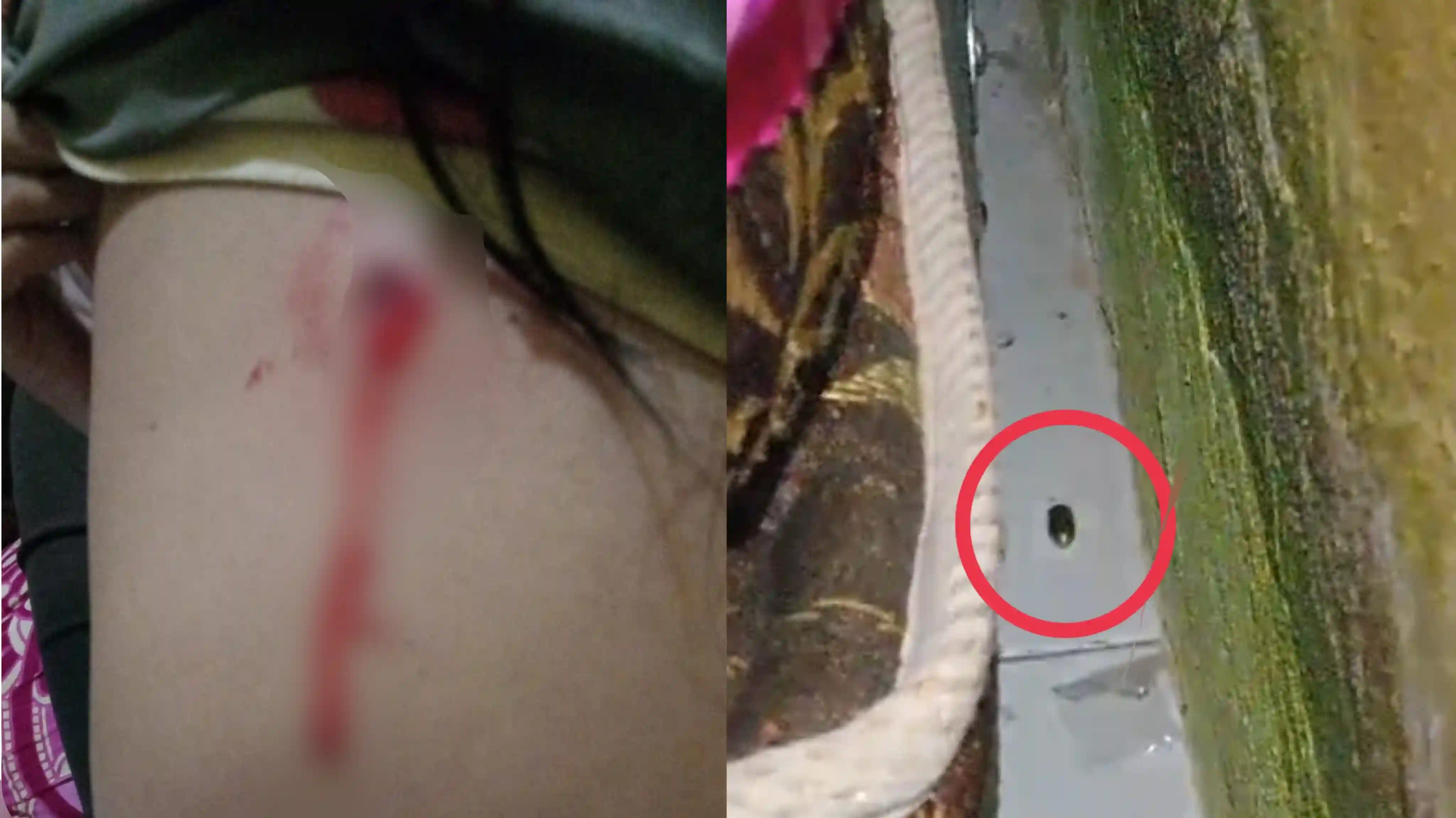 Kondisi korban dengan luka yang diduga bekas tembakan (kiri) dan selongsong peluru di bawah kasur (kanan). Foto: Kolase.