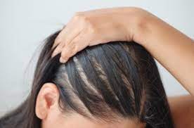 Rambut menjadi salah satu bagian tubuh terpenting, khususnya bagi para wanita. Rambut tak ubahnya sebuah mahkota yang perlu dijaga kondisinya agar tampak selalu indah. Foto Repro Tresemme
