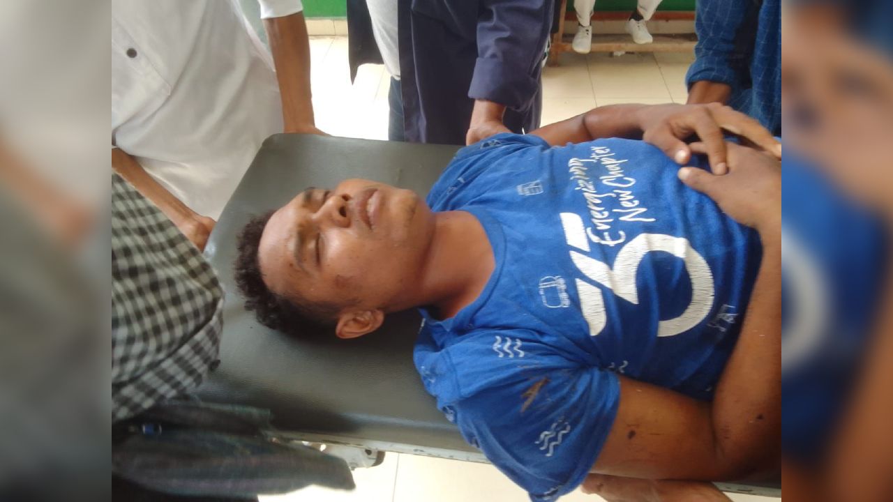 Mahasiswa yang jatuh dari lantai 3 Fakultas Teknik Unidayan Baubau alami patah tulang pada area paha kiri. Foto: Ist.
