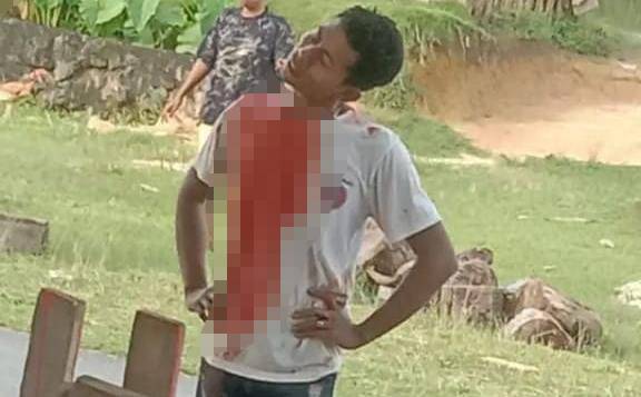 Korban muncul bersimbah darah setelah sempat melakukan aksi kejar-kejaran dengan pelaku. Foto: Ist.