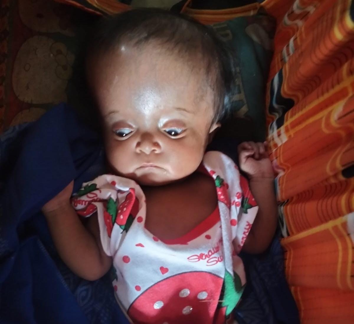 Bayi pengidap Hidrosefalus di Desa Wakoila, Kecamatan Sawerigadi, Muna Barat menerima bantuan dari FH connection. Foto: Ist