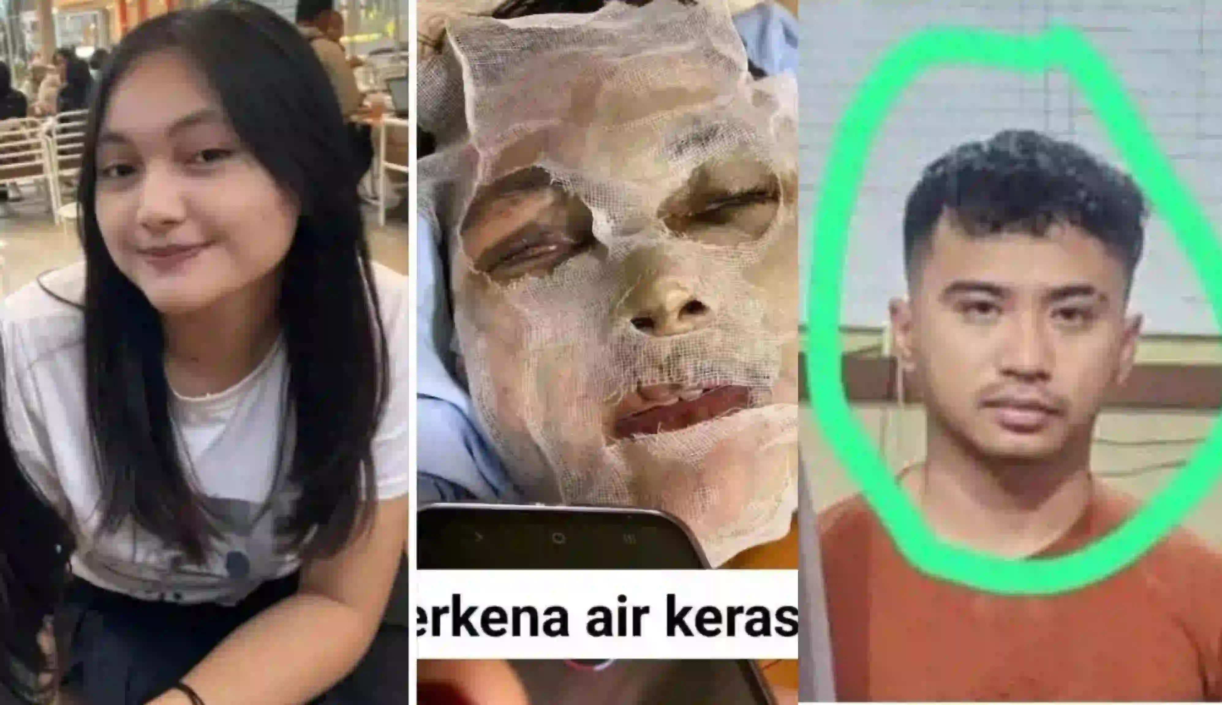 Belly Villsen otaki penyiraman air keras terhadap mantan pacar, Natasya Hutagalung. Foto: Repro Jawapos