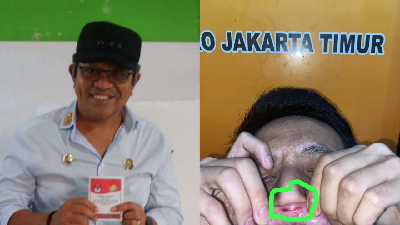 Pj Bupati Buton Selatan, Ridwan Badallah (kiri), dan mahasiswa yang mengaku korban kekerasan, Irsan Ardianto (kanan). Foto: Ali Iskandar Majid/Ist